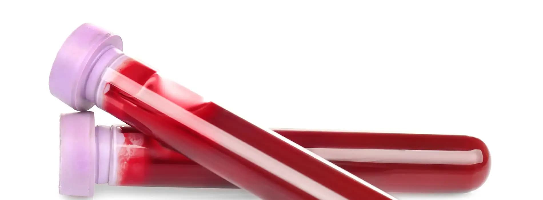 Badanie grupy krwi - na czym polega, jaka jest cena?