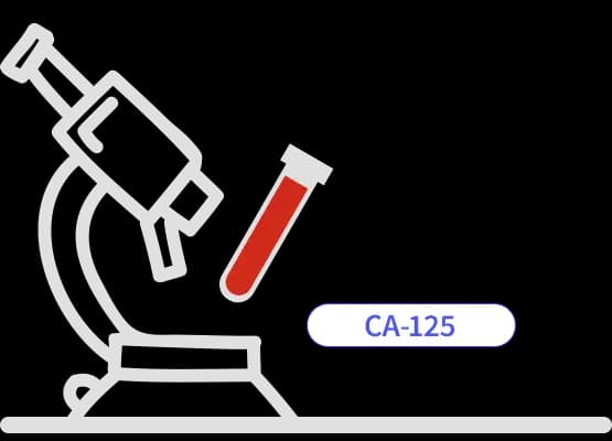 CA 125 – marker raka jajnika