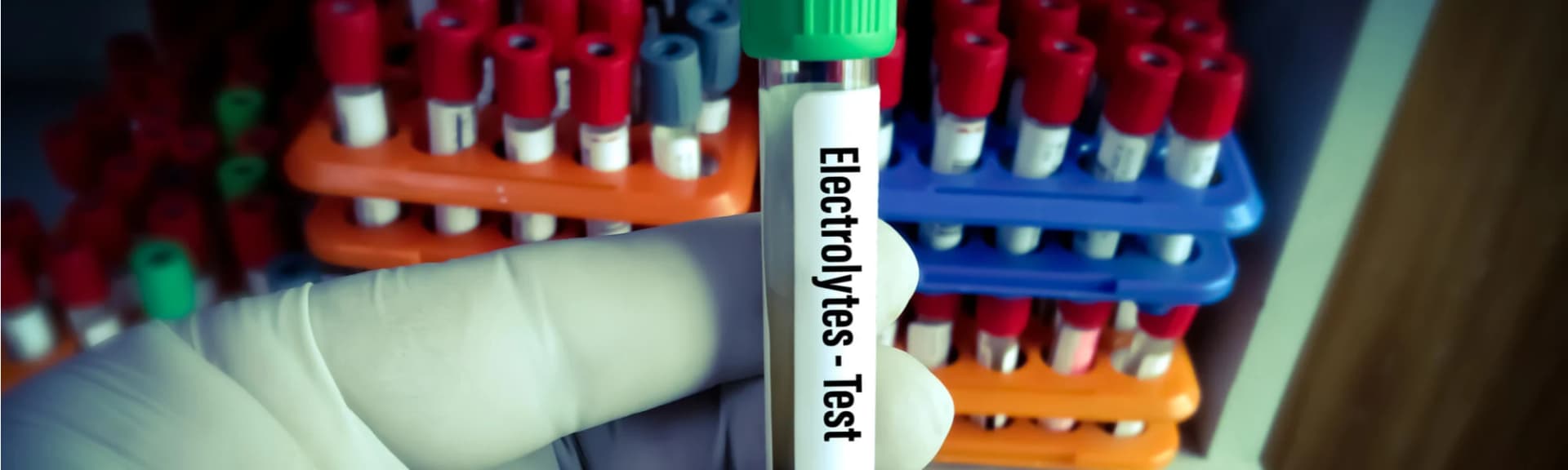 Elektrolity - co to jest, kiedy i jak je uzupełnić? Niedobór elektrolitów - objawy, przyczyny