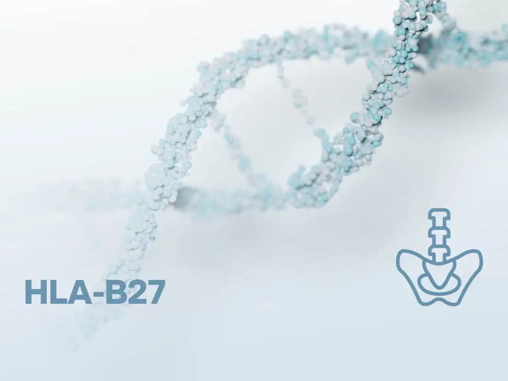 HLA-B27 - Zesztywniające zapalenie stawów kręgosłupa (ZZSK)