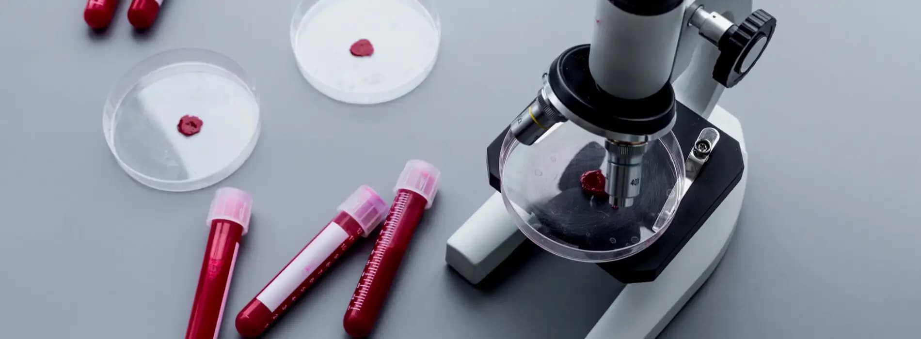 Morfologia krwi - na czym polega i dlaczego warto ją wykonywać?