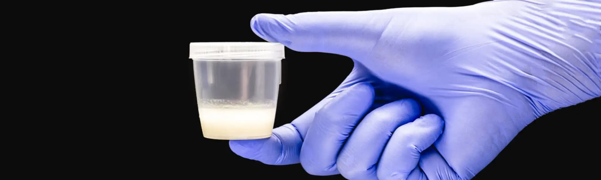 Badanie nasienia (seminogram) - jak się przygotować i na czym polega badanie nasienia?