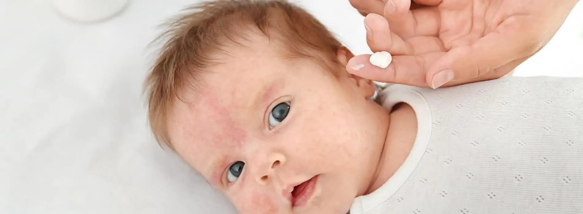 Czym jest skaza białkowa?