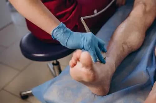 USG Doppler tętnic kończyn dolnych - dwie nogi