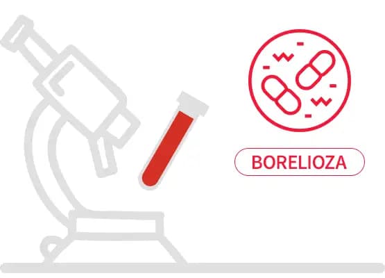 Borelioza - panel podstawowy, badanie przeciwciał IgG i IgM