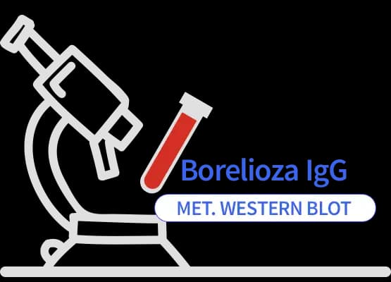 Borelioza IgG met. Immunoblot