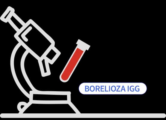 Borelioza IgG
