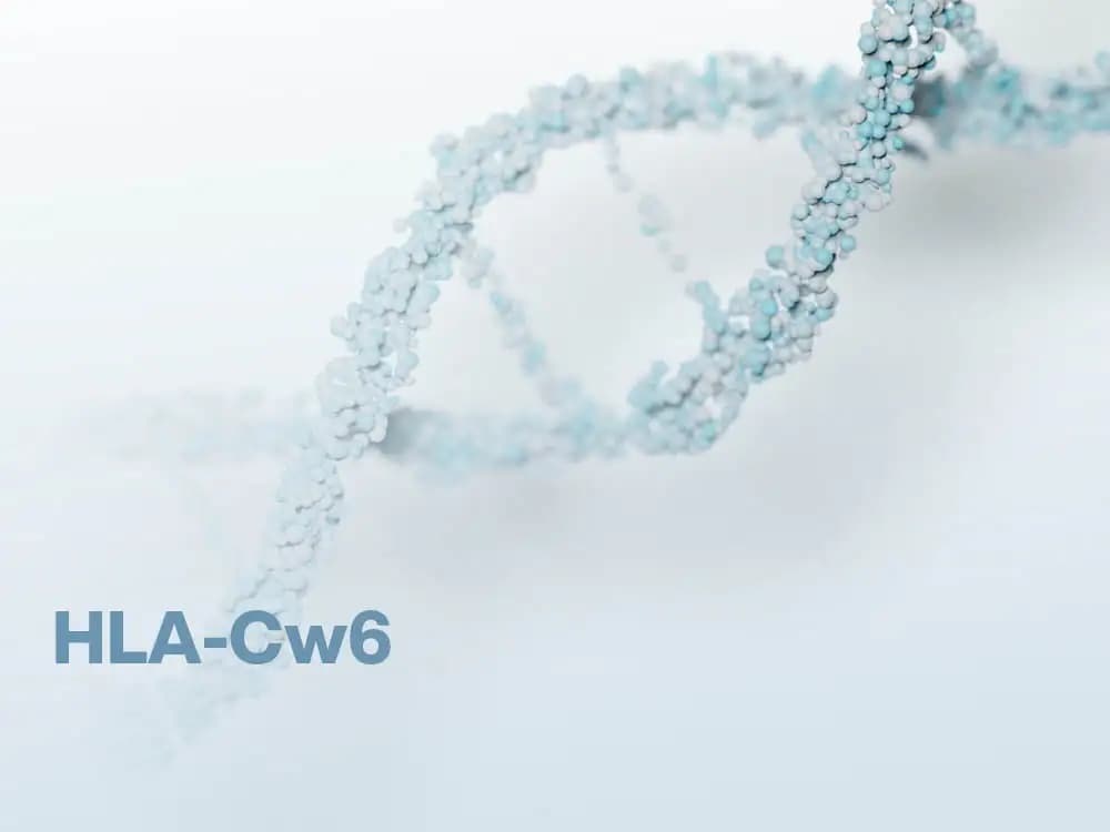 Łuszczyca – badanie HLA-Cw6