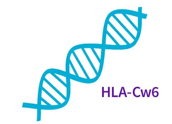 Cukrzyca typu MODY 2 - badanie wybranych fragmentów genu GCK1