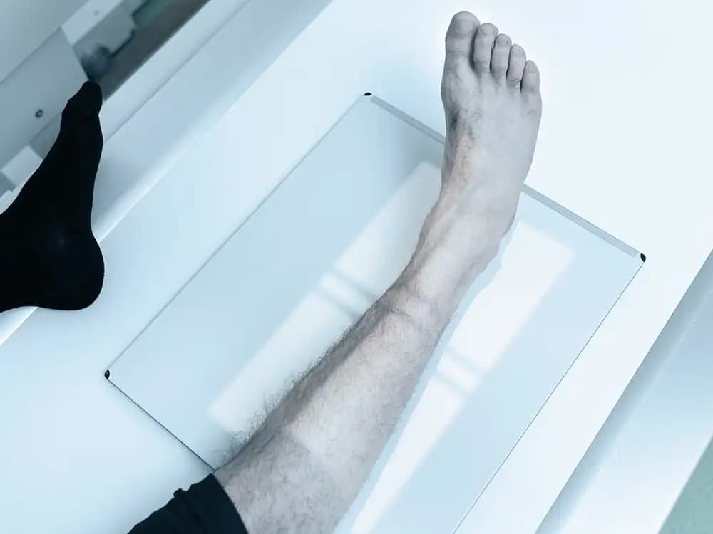 Rezonans magnetyczny kończyny dolnej z podziałem na okolice (stopa, podudzie, udo), 1 odcinek, z możliwością kontrastu