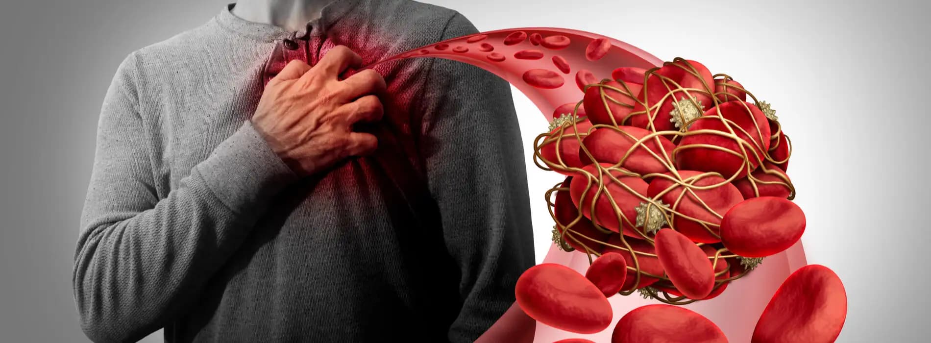 Trombofilia wrodzona - co to jest, jak rozpoznać, badania i leczenie