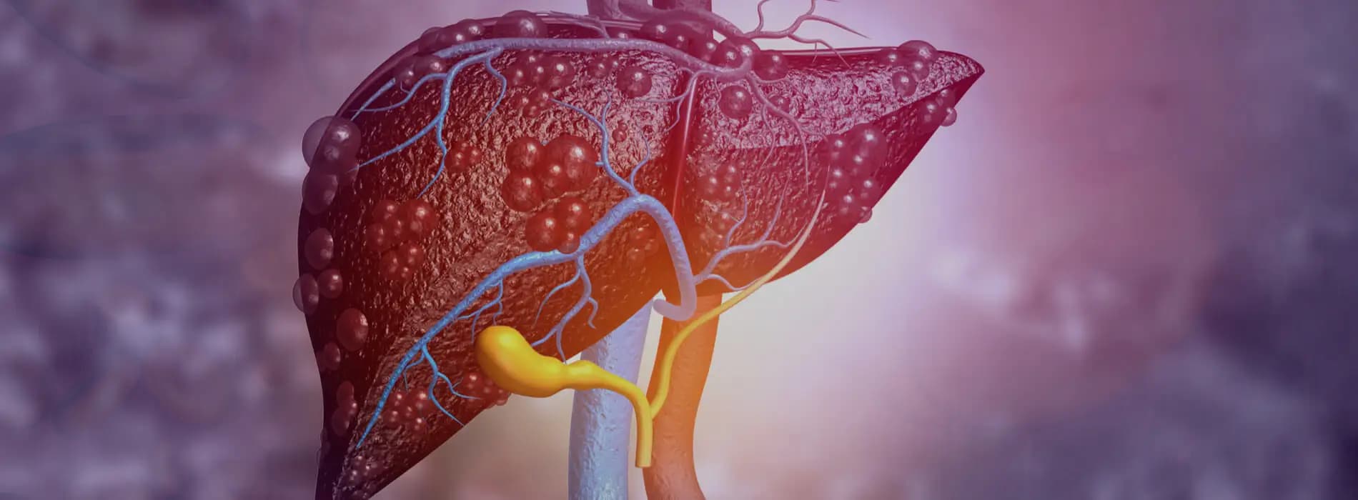 Wirusowe zapalenie wątroby typu B