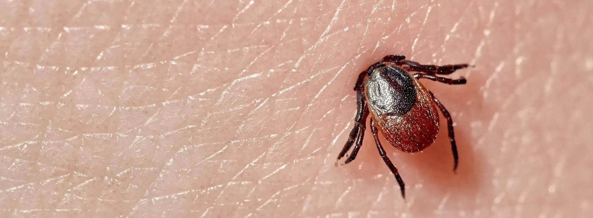 Ugryzł mnie kleszcz - jakie badania wykonać na boreliozę?