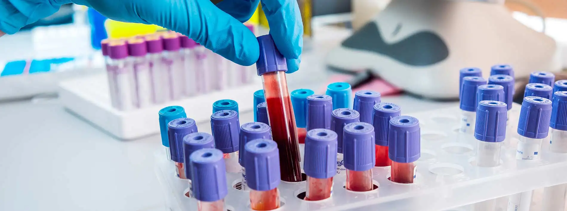 Badanie na nietolerancje pokarmowe - przeciwciała IgG a IgG4