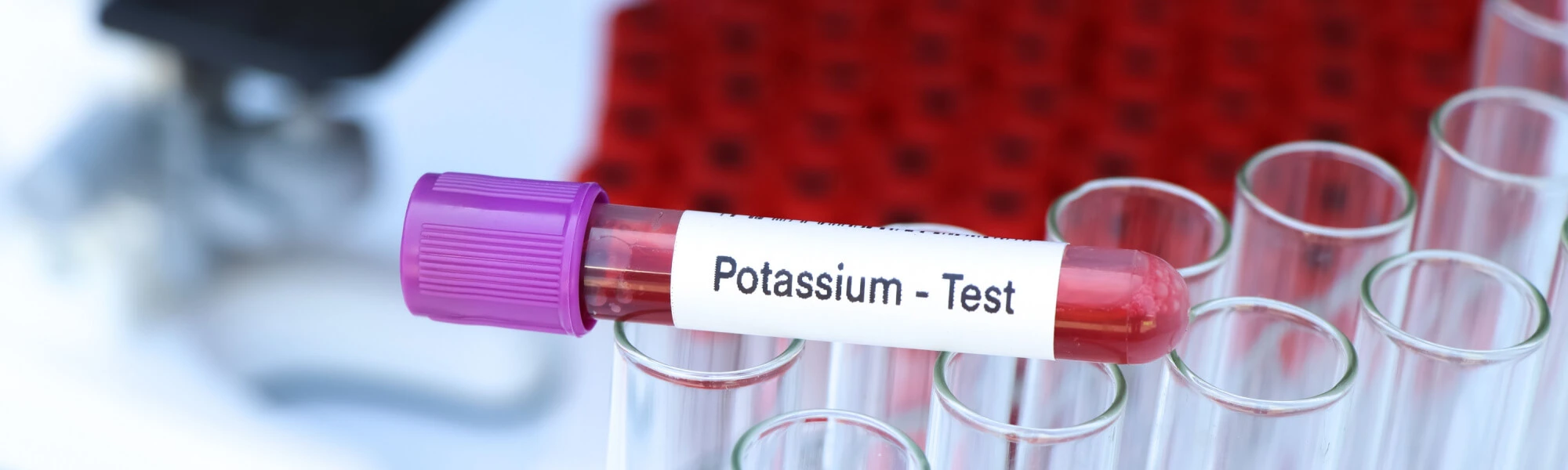 Potas — objawy, przyczyny, leczenie niedoboru potasu. Za co odpowiada potas w organizmie i kiedy suplementować?