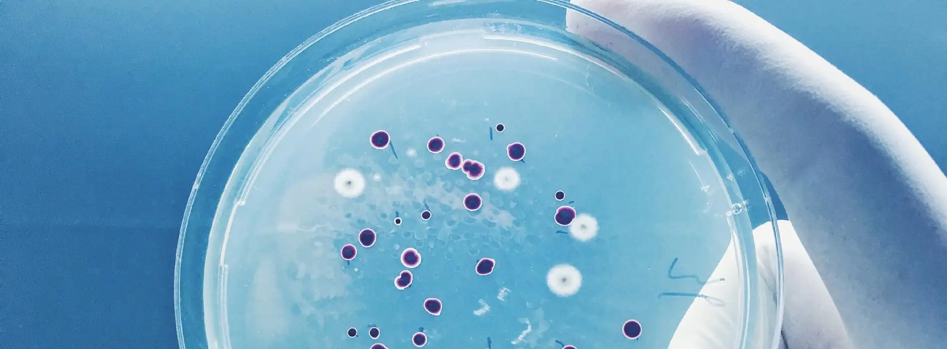 Pseudomonas - bakterie o dwóch twarzach