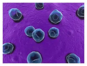 Chlamydioza - przyczyny, objawy, diagnostyka, leczenie i profilaktyka