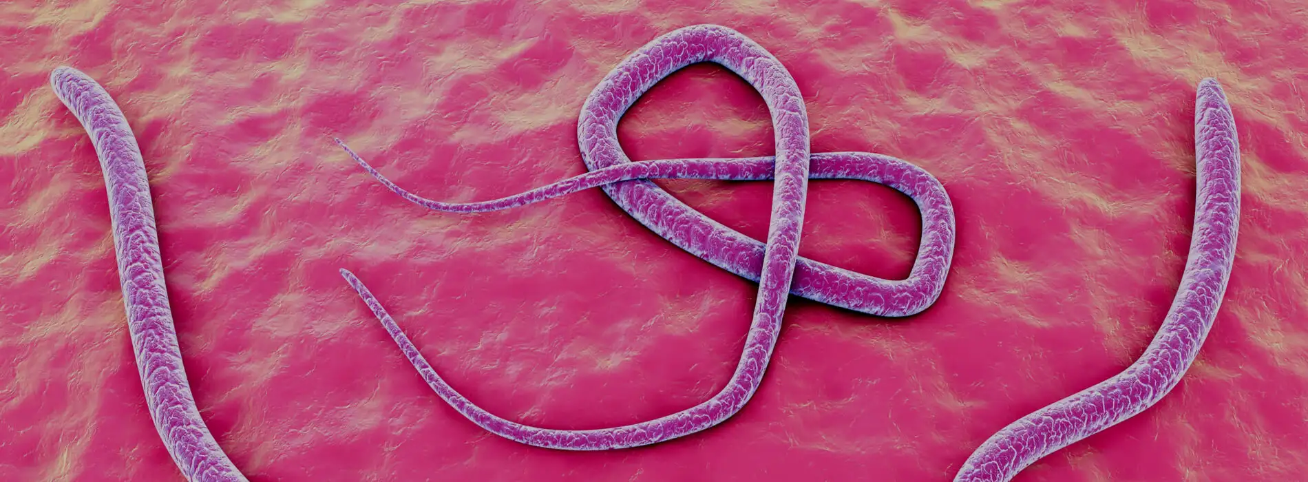 Glista ludzka - przyczyny, objawy i diagnostyka glistnicy