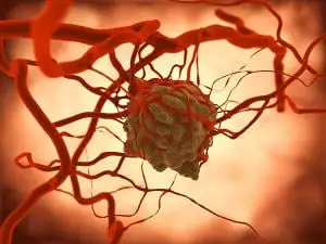 Jak powstaje nowotwór - rodzaje, geny, mutacje i etapy