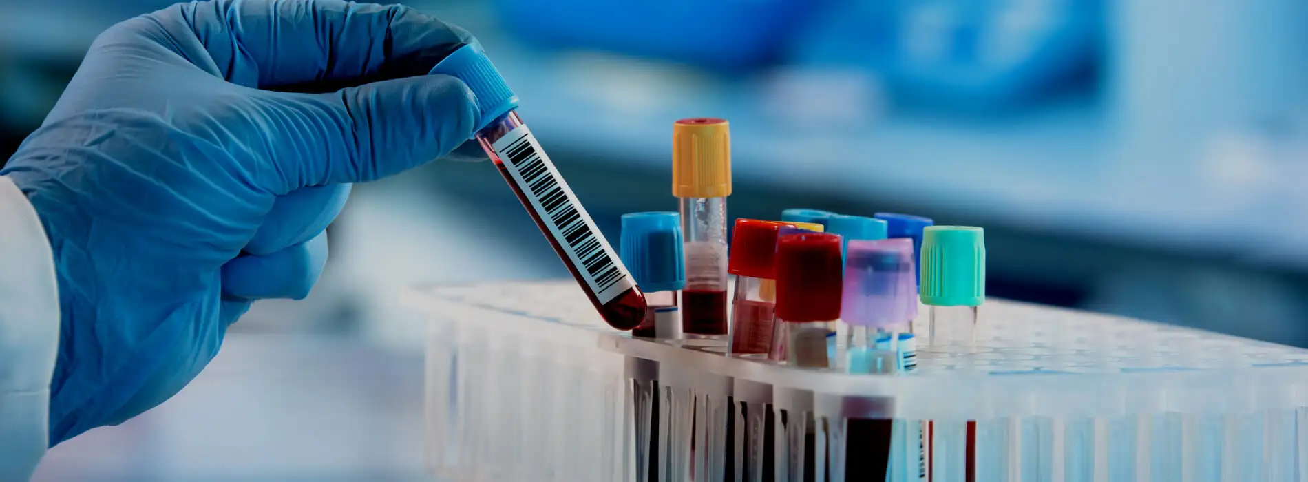 Badanie markerów nowotworowych - kiedy warto je wykonać?