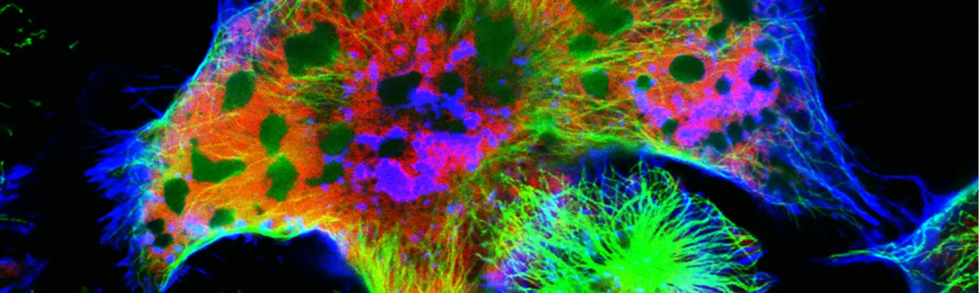 Neuroblastoma - objawy, rokowania, przyczyny, leczenie