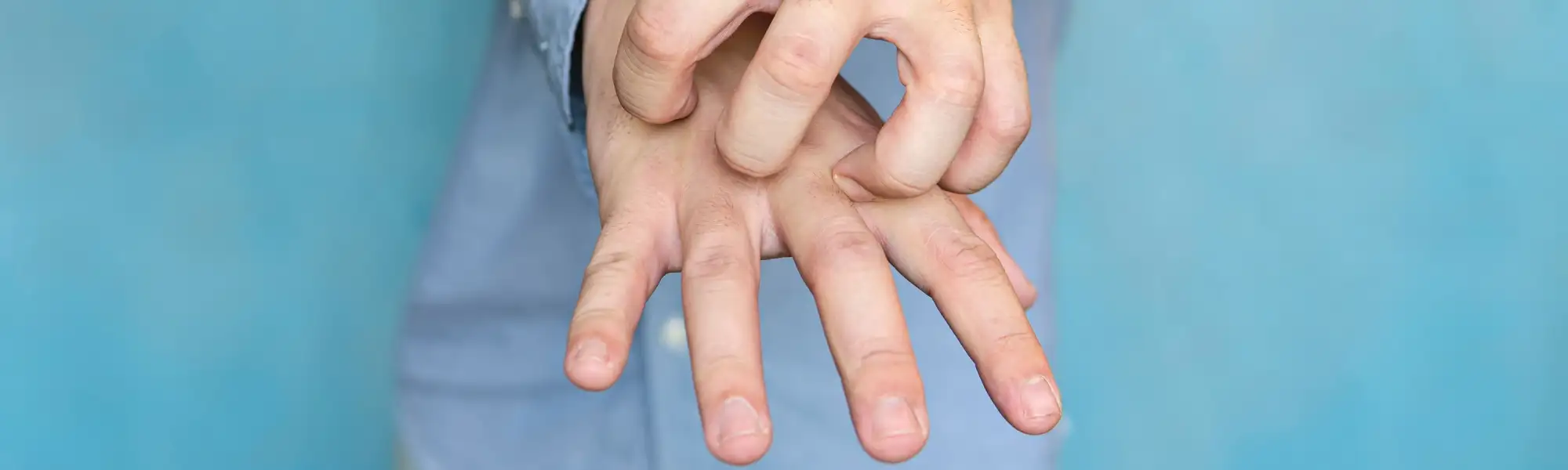 Świerzb na dłoniach i stopach — jak rozpoznać i skutecznie wyleczyć tę uciążliwą chorobę skóry?